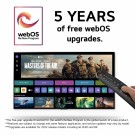 LG 75