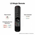 LG 75